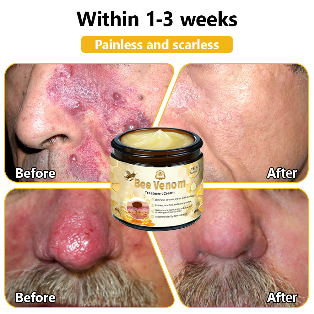 Skin tested certification | ๐๐๐๐๐ผโข Bee Venom Skin Treatment Cream (AAD Recommended) (Up to 70% off)