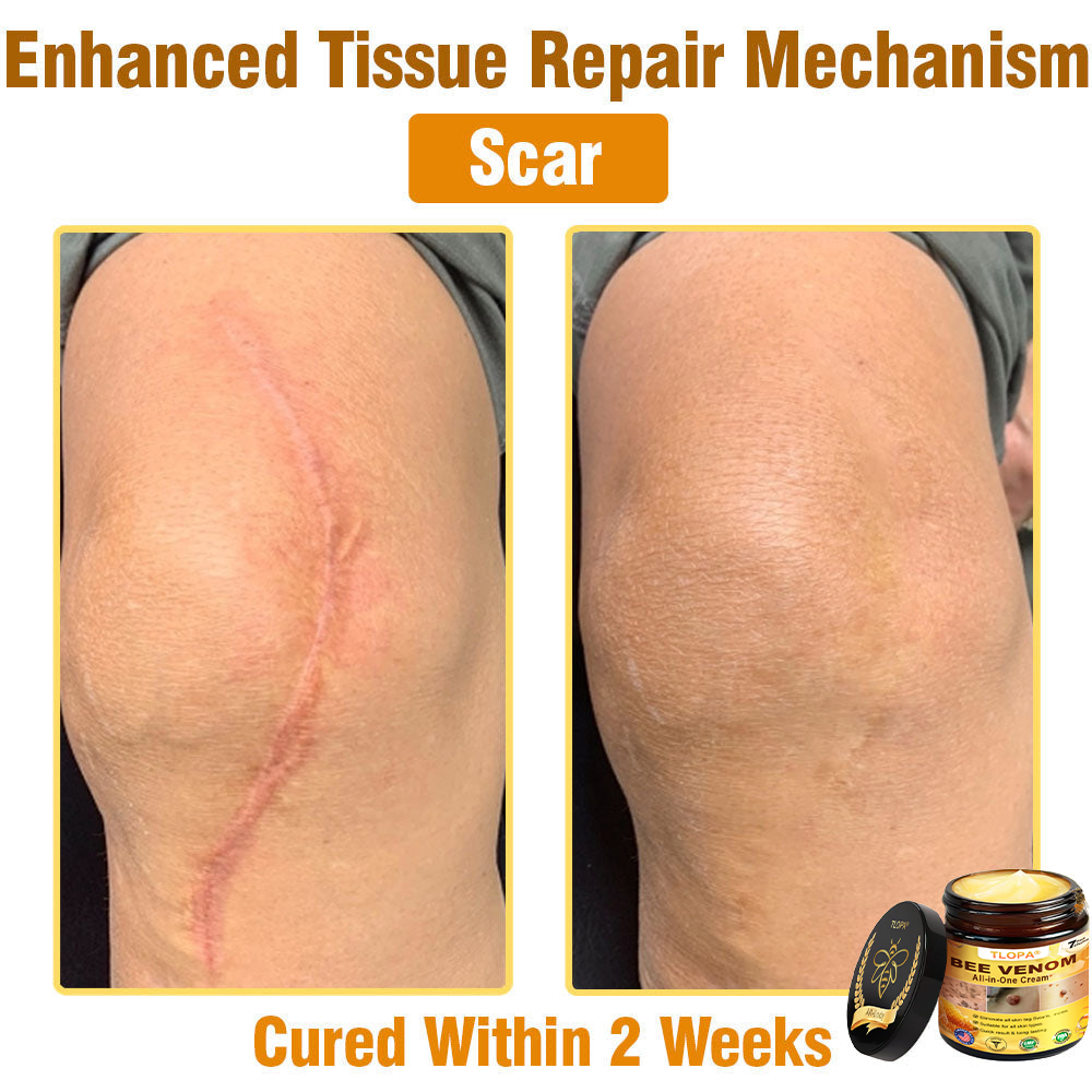 TLOPA® Bee Venom All-in-One Cream US Dermatologist Approved-