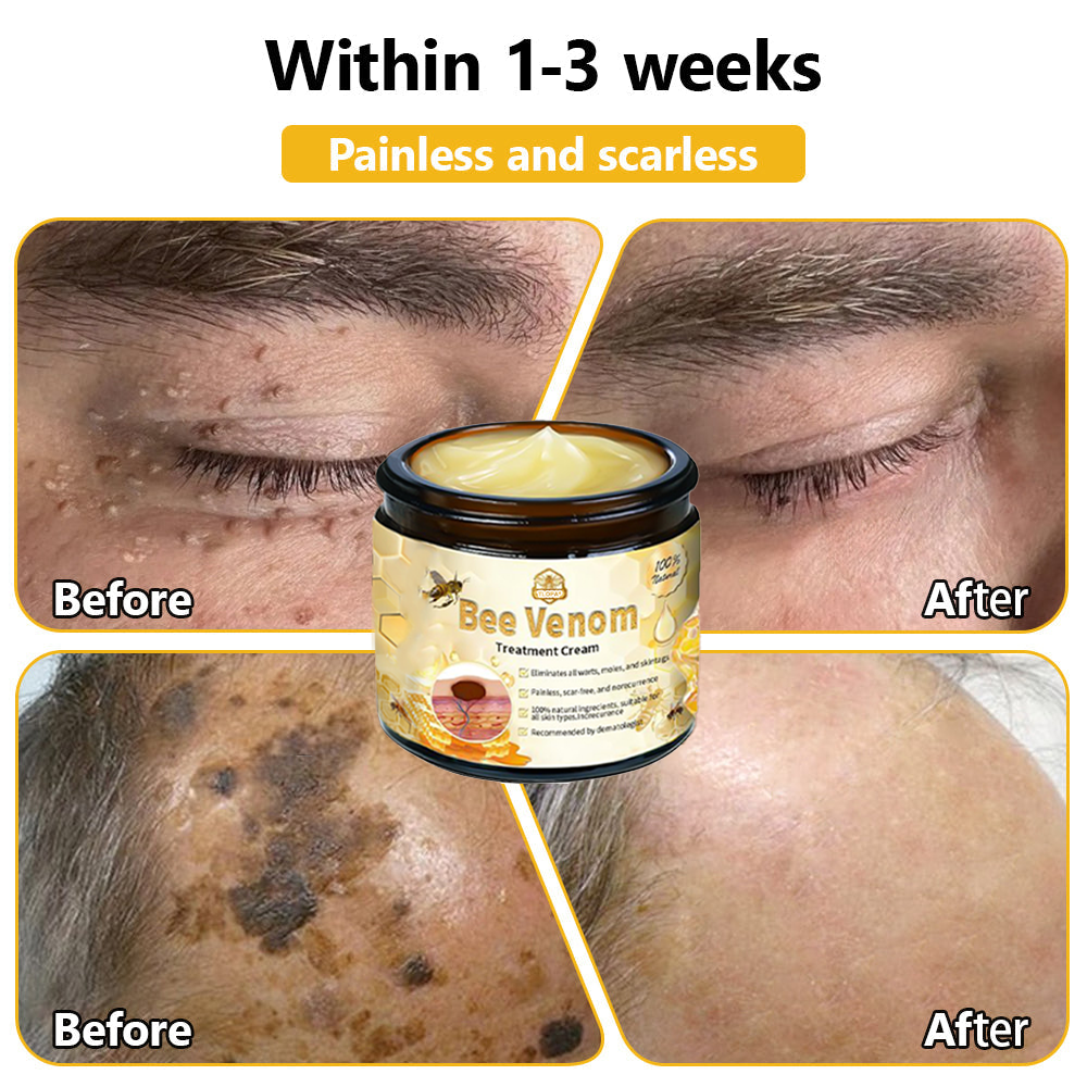 Skin tested certification | ๐๐๐๐๐ผโข Bee Venom Skin Treatment Cream (AAD Recommended) (Up to 70% off)