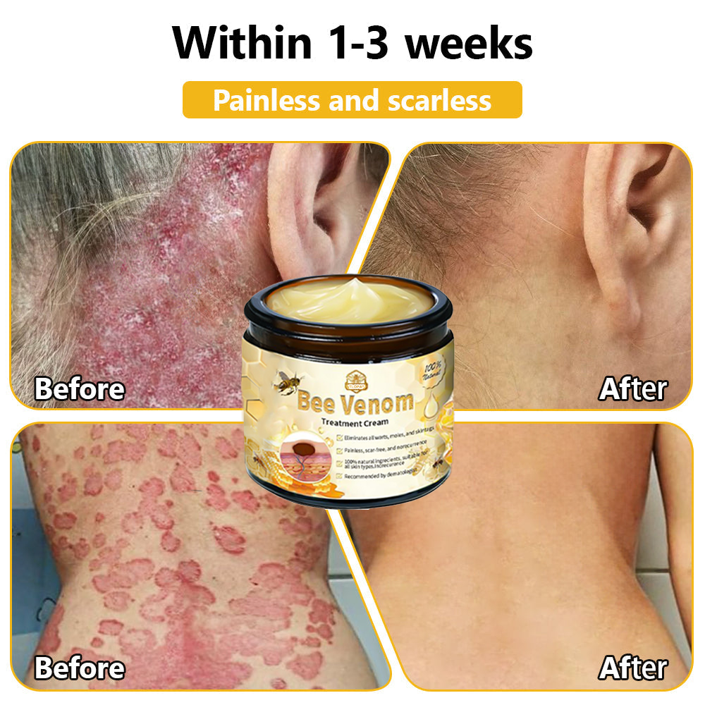 Skin tested certification | ๐๐๐๐๐ผโข Bee Venom Skin Treatment Cream (AAD Recommended) (Up to 70% off)