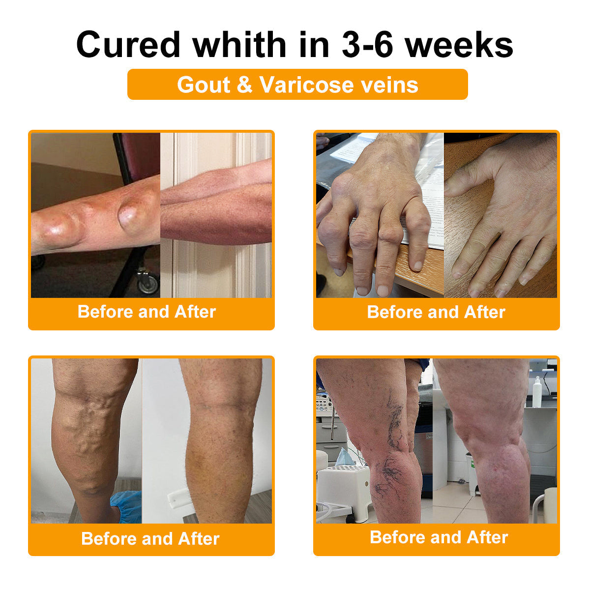 TLOPA® Botulinum Toxin & Bee Venom Pain-Relief Bone Healing Cream🌟Extra 30% off on sale items!