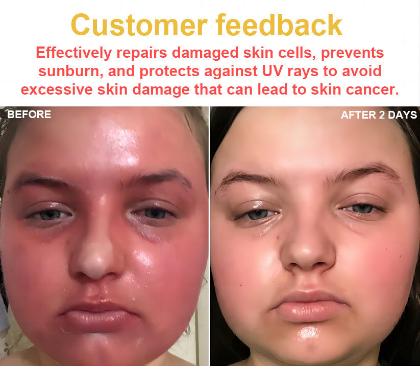 TLOPA® Bee Venom Skin Cream(👨⚕AAD Recommended),for Remove Warts, Acne and Scars ✅