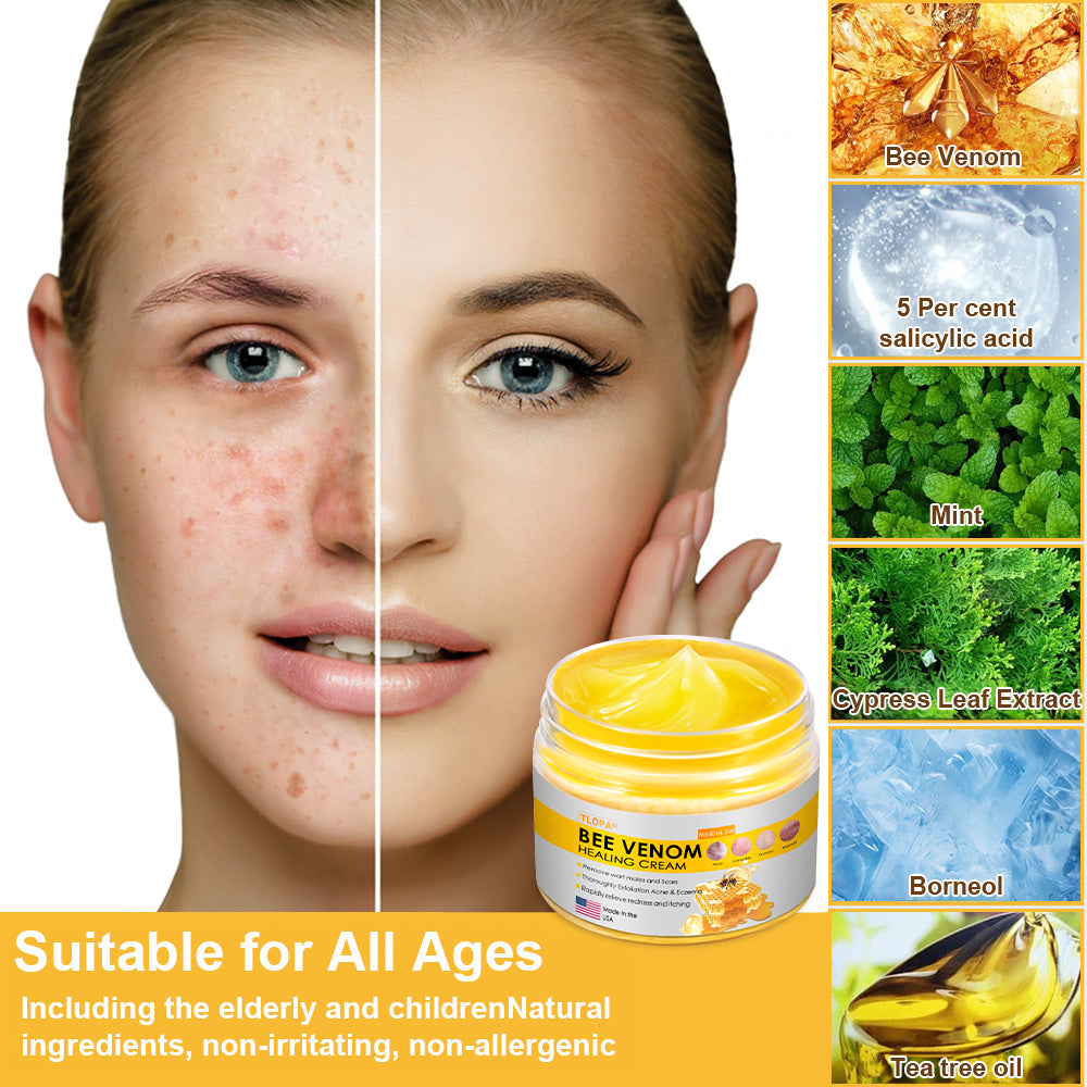 TLOPA® Bee Venom Skin Cream(👨⚕AAD Recommended),for Remove Warts, Acne and Scars ✅