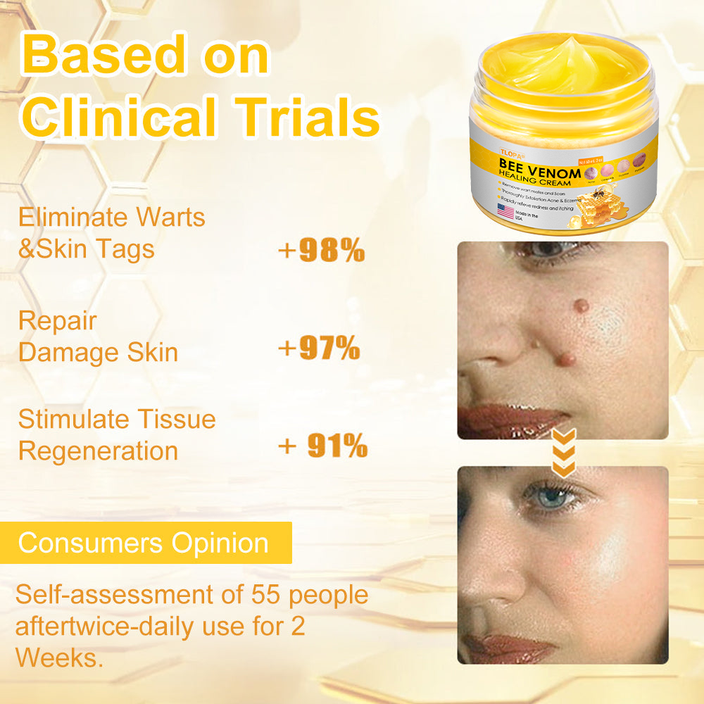 TLOPA® Bee Venom Skin Cream(👨⚕AAD Recommended),for Remove Warts, Acne and Scars ✅