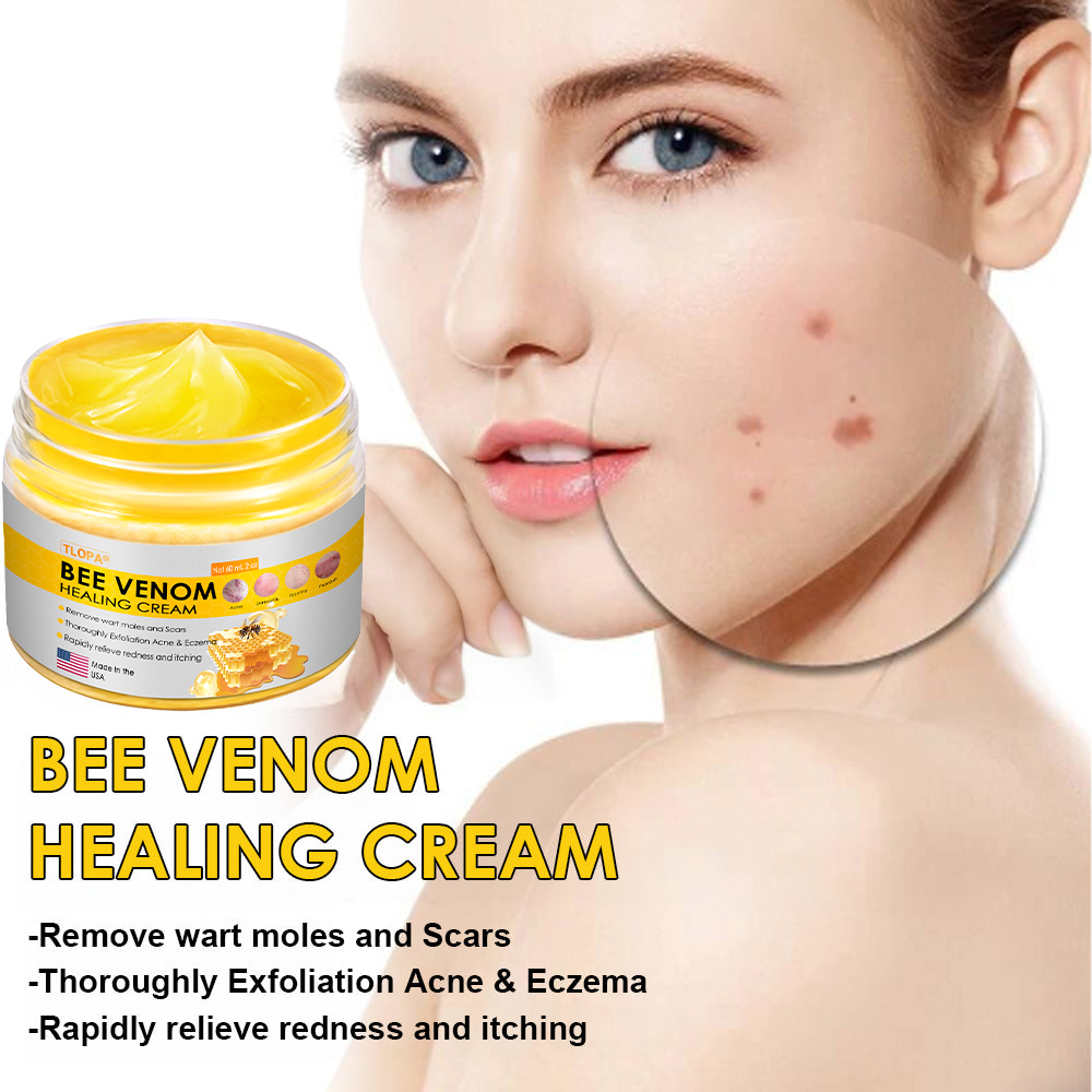 TLOPA® Bee Venom Skin Cream(👨⚕AAD Recommended),for Remove Warts, Acne and Scars ✅