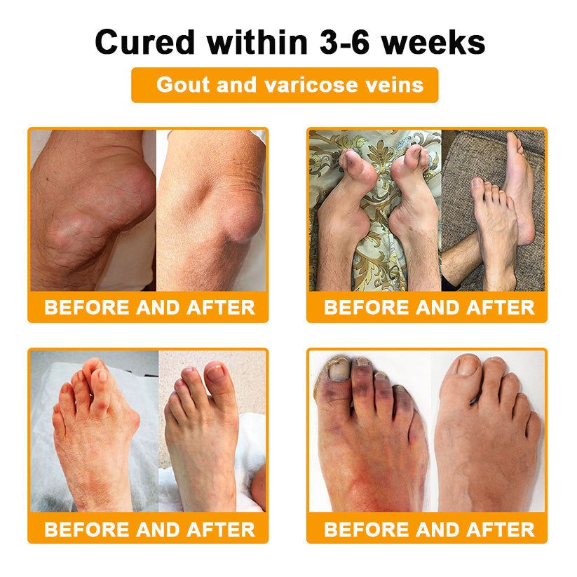 TLOPA® Botulinum Toxin & Bee Venom Pain-Relief Bone Healing Cream🌟Extra 30% off on sale items!