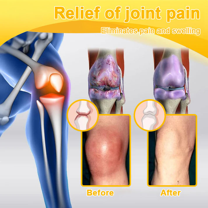 TLOPA® Botulinum Toxin & Bee Venom Pain-Relief Bone Healing Cream🌟Extra 30% off on sale items!