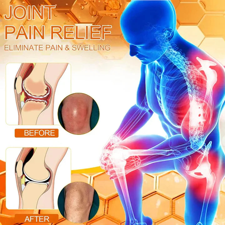 Official Store: TLOPA® Bee-Venom Pain-Relief Bone Healing Cream👨⚕️USA Osteopathic Medical Association (AAOS)Approved(Reducing joint swelling, pain, stiffness, redness, warmth, soreness, and joint fatigue)