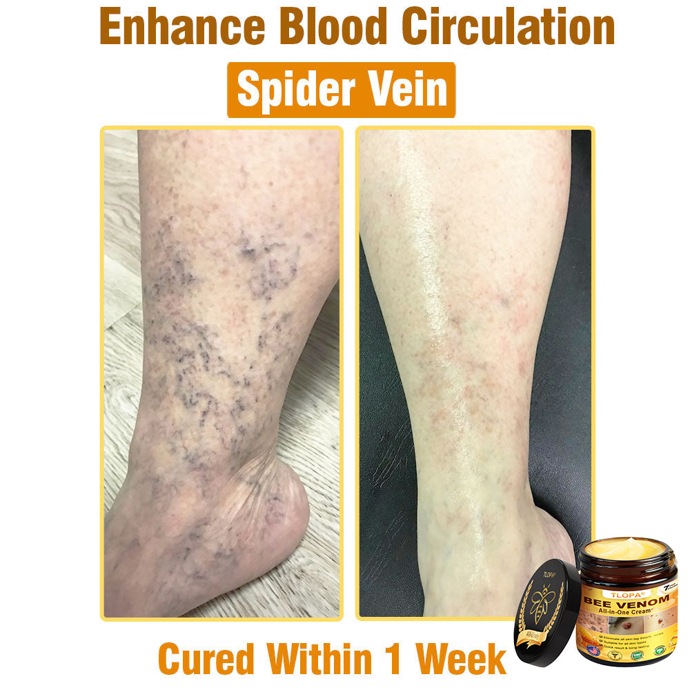 TLOPA® Bee Venom All-in-One Cream US Dermatologist Approved-