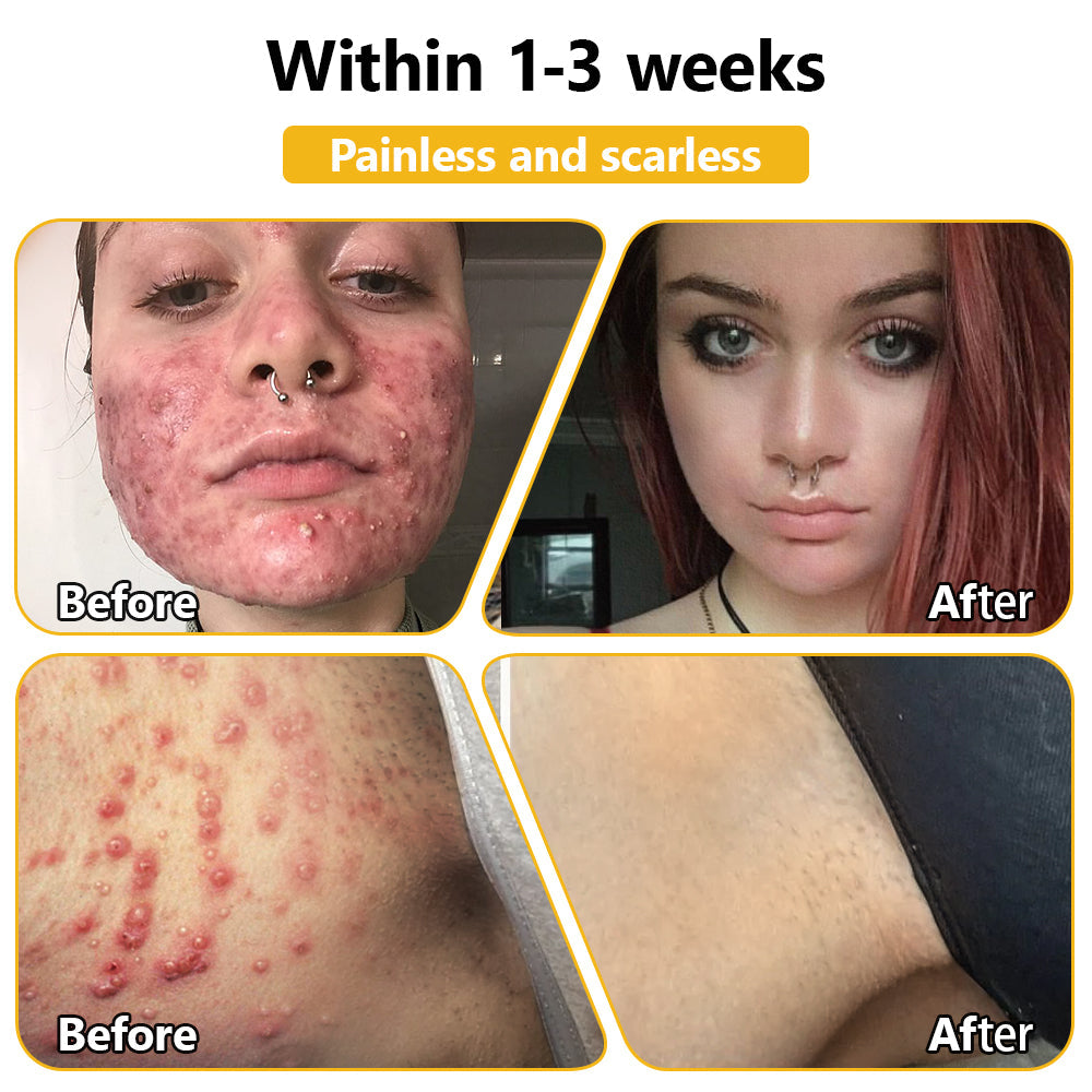 Skin tested certification | ๐๐๐๐๐ผโข Bee Venom Skin Treatment Cream (AAD Recommended) (Up to 70% off)