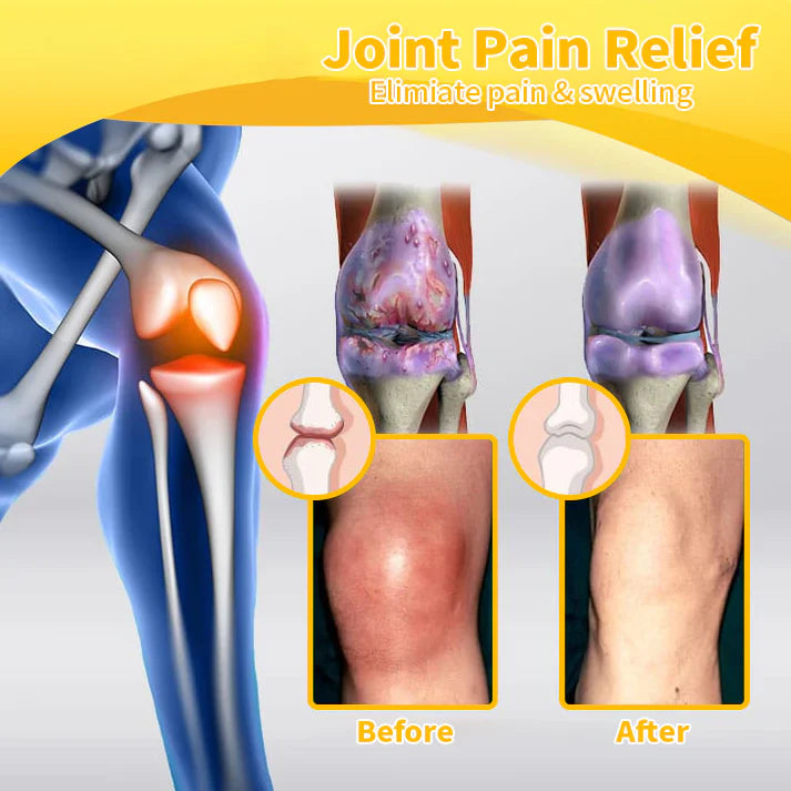 Official Store: TLOPA® Bee-Venom Pain-Relief Bone Healing Cream👨⚕️USA Osteopathic Medical Association (AAOS)Approved(Reducing joint swelling, pain, stiffness, redness, warmth, soreness, and joint fatigue)