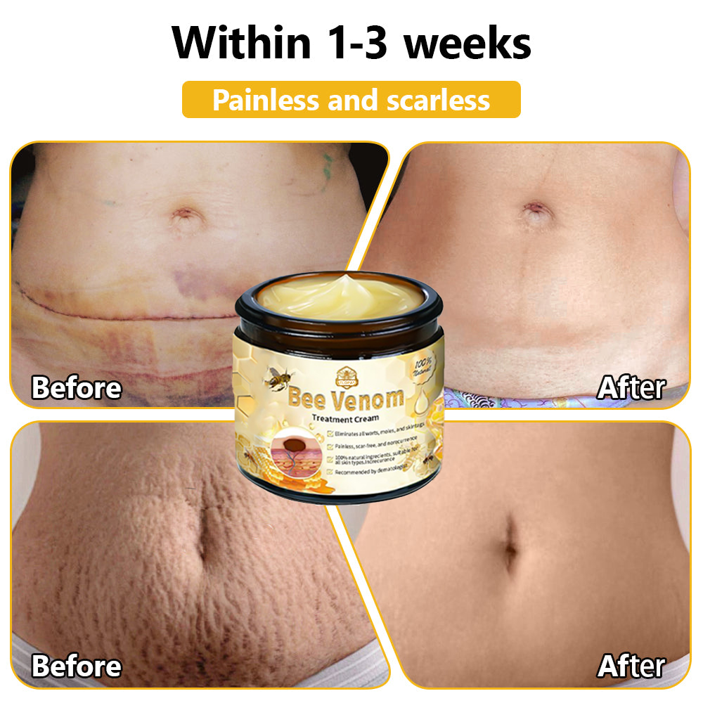 Skin tested certification | ๐๐๐๐๐ผโข Bee Venom Skin Treatment Cream (AAD Recommended) (Up to 70% off)