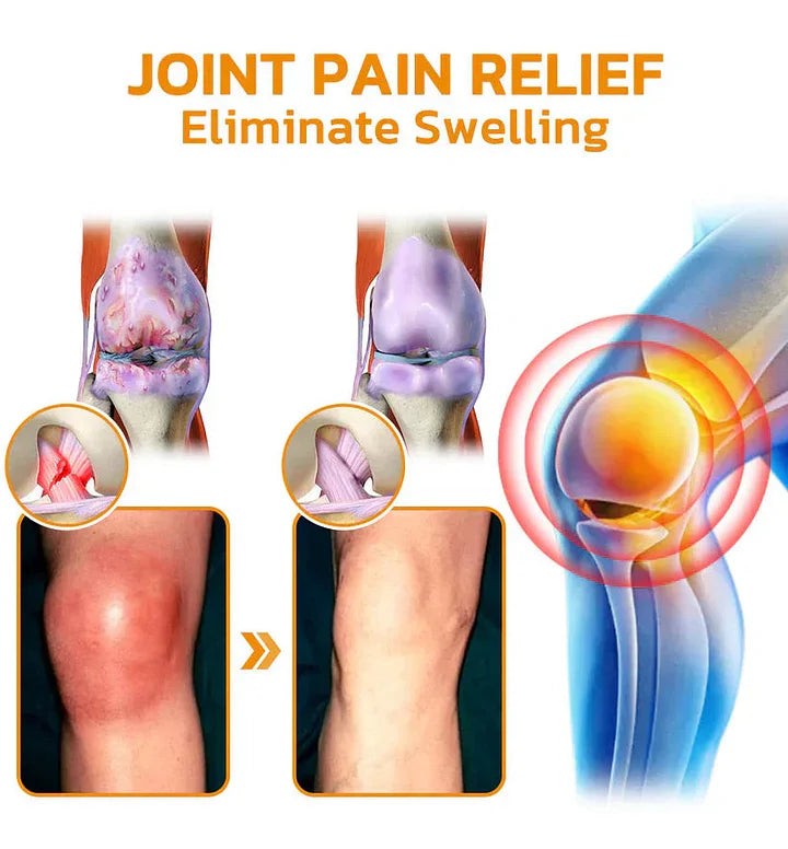 Official Store: TLOPA® Bee-Venom Pain-Relief Bone Healing Cream👨⚕️USA Osteopathic Medical Association (AAOS)Approved(Reducing joint swelling, pain, stiffness, redness, warmth, soreness, and joint fatigue)