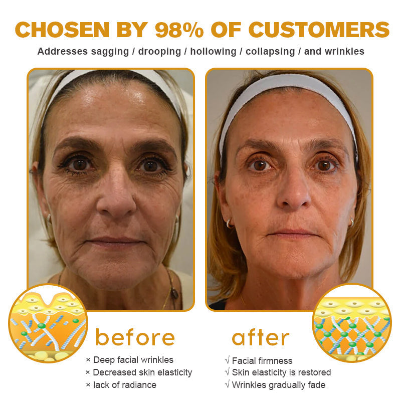 (Made and Shipped from USA) ✨TLOPA® Botox Bee Venom Wrinkle Removal Cream- LAST DAY 70% OFF✨