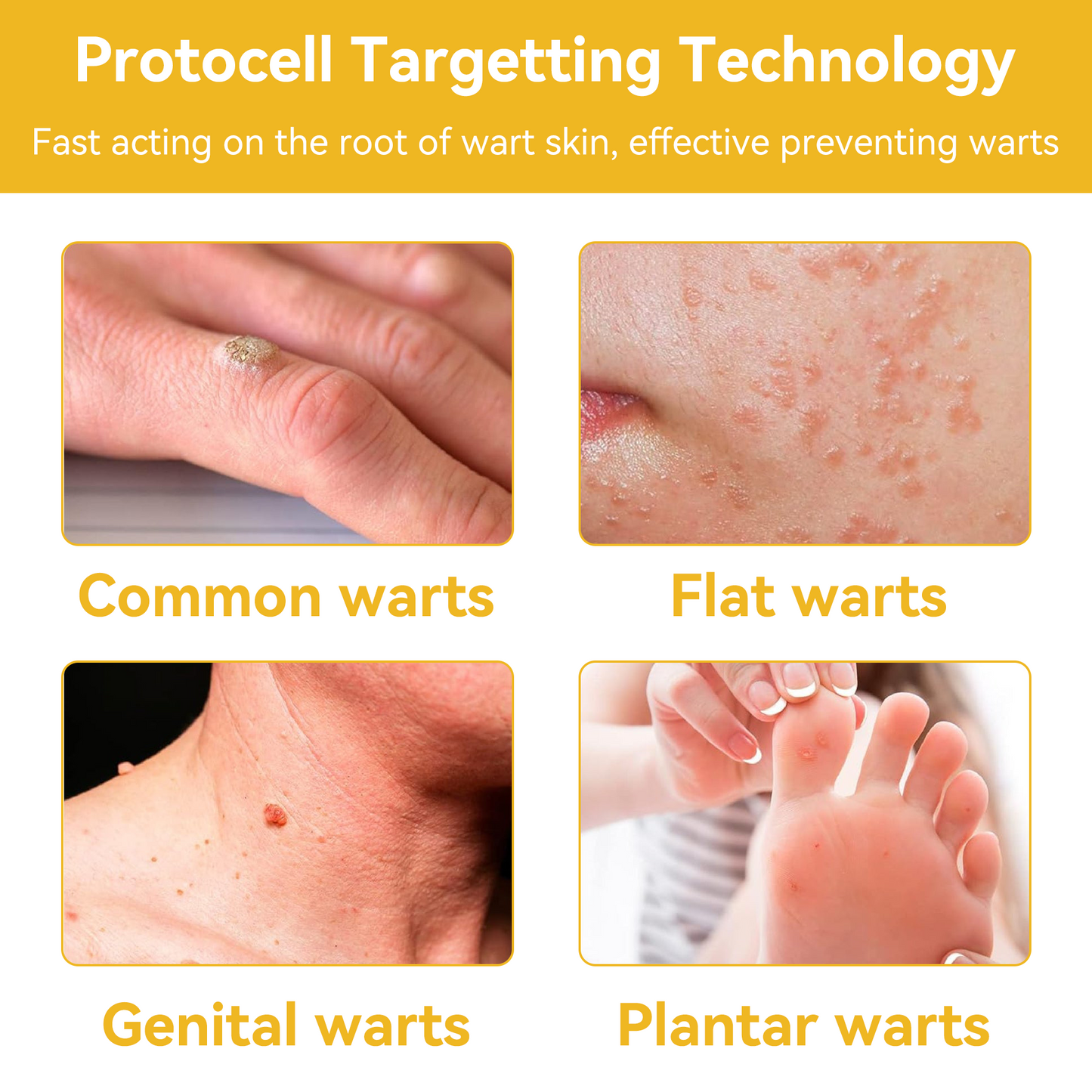 Skin tested certification | 𝙏𝙇𝙊𝙋𝘼™ Bee Venom Skin Treatment Cream (AAD Recommended) (Up to 70% off)