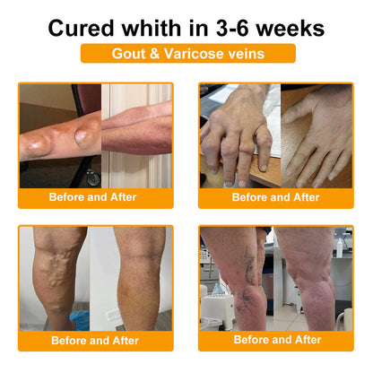 TLOPA® Botulinum Toxin & Bee Venom Pain-Relief Bone Healing Cream🌟Extra 30% off on sale items!