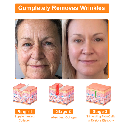 𝗧𝗟𝗢𝗣𝗔™ Powerful All-Body Skin Treatment Cream (AAD Recommended)🥑