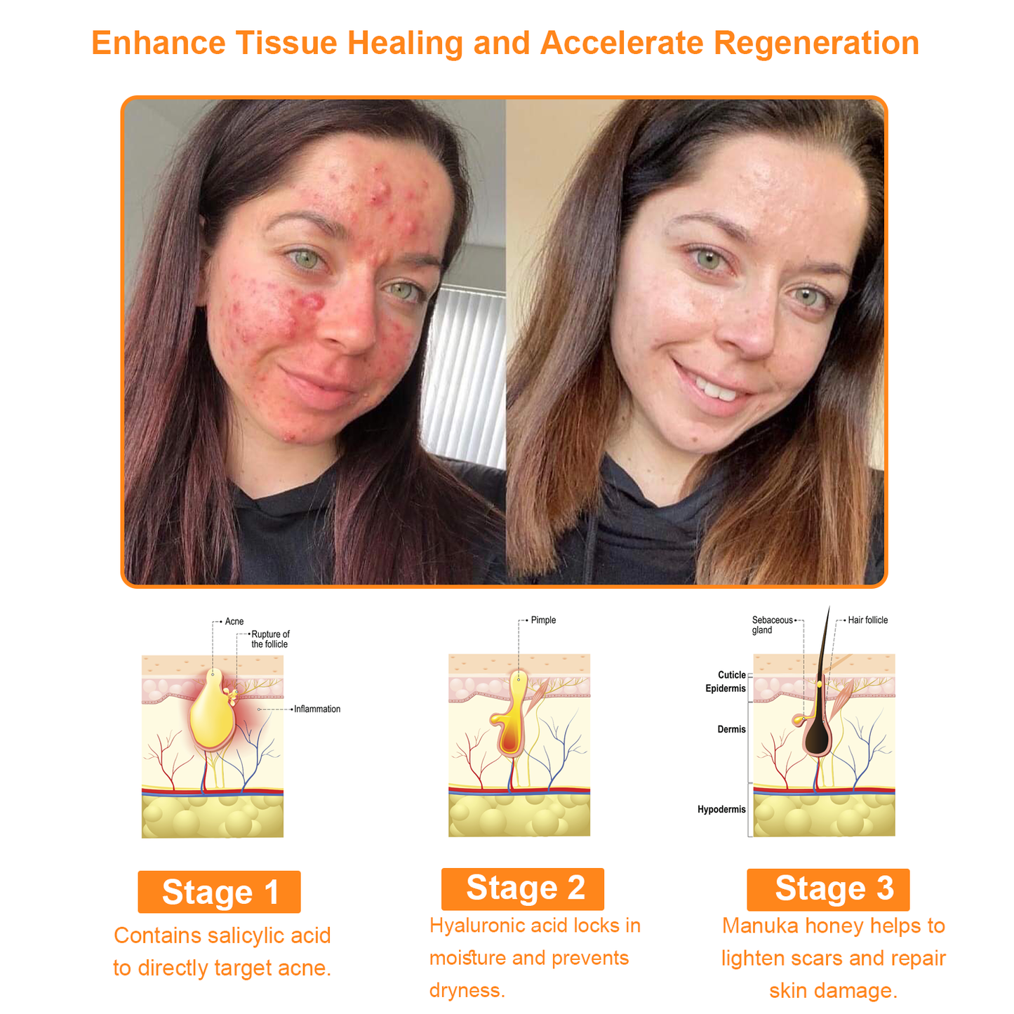 𝗧𝗟𝗢𝗣𝗔™ Powerful All-Body Skin Treatment Cream (AAD Recommended)