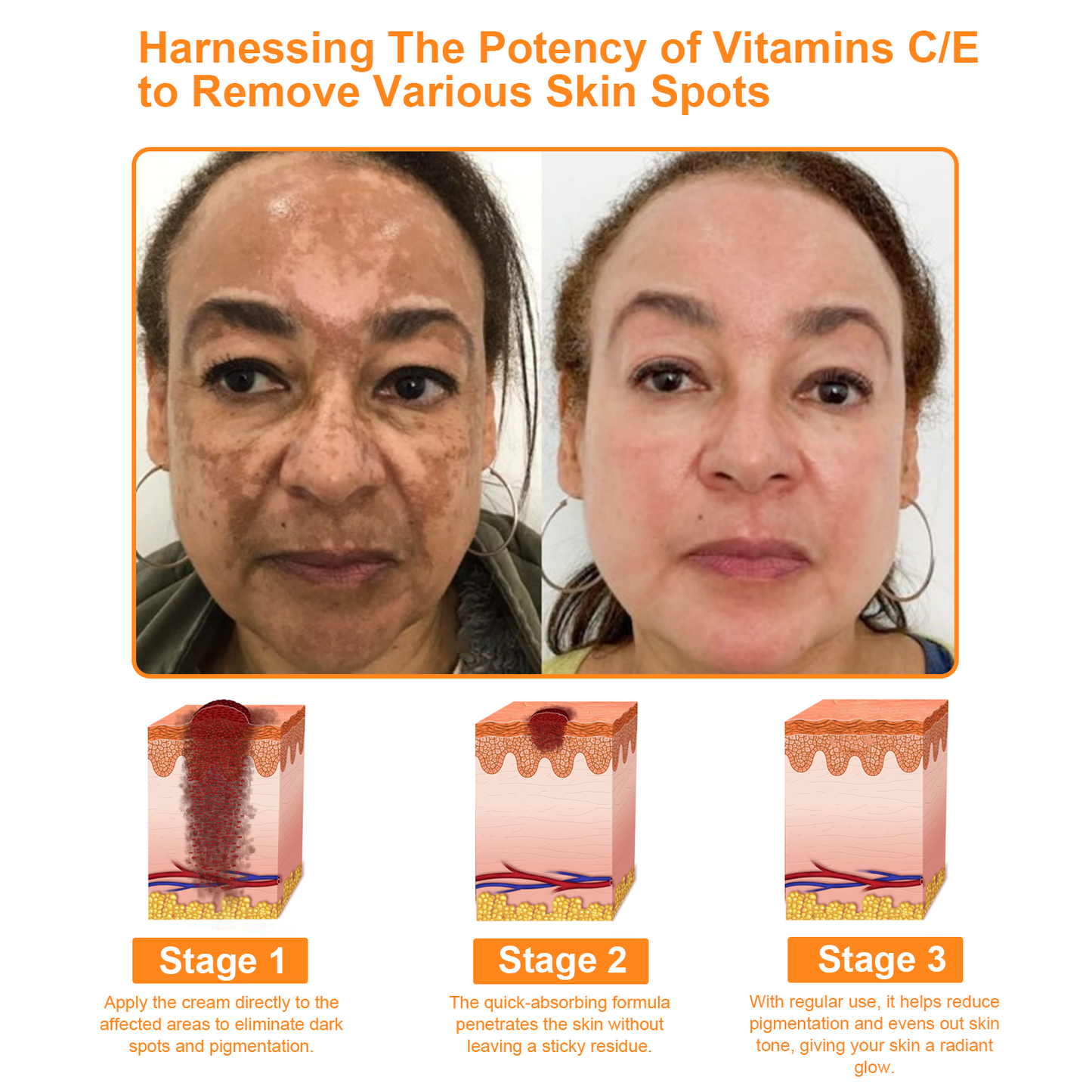 𝗧𝗟𝗢𝗣𝗔™ Powerful All-Body Skin Treatment Cream (AAD Recommended)