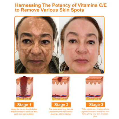 𝗧𝗟𝗢𝗣𝗔™ Powerful All-Body Skin Treatment Cream (AAD Recommended)
