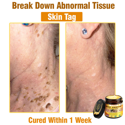TLOPA® Bee Venom All-in-One Cream US Dermatologist Approved-