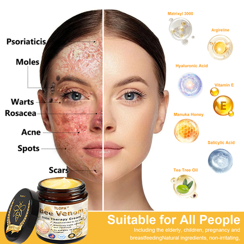 𝗧𝗟𝗢𝗣𝗔™ Powerful All-Body Skin Treatment Cream (AAD Recommended)🥑