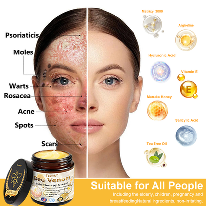 𝗧𝗟𝗢𝗣𝗔™ Powerful All-Body Skin Treatment Cream (AAD Recommended)🥑