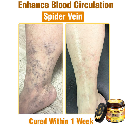TLOPA® Bee Venom All-in-One Cream US Dermatologist Approved-