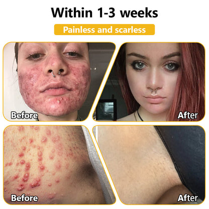 Skin tested certification | 𝙏𝙇𝙊𝙋𝘼™ Bee Venom Skin Treatment Cream (AAD Recommended) (Up to 70% off)