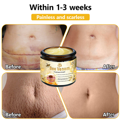 Skin tested certification | 𝙏𝙇𝙊𝙋𝘼™ Bee Venom Skin Treatment Cream (AAD Recommended) (Up to 70% off)