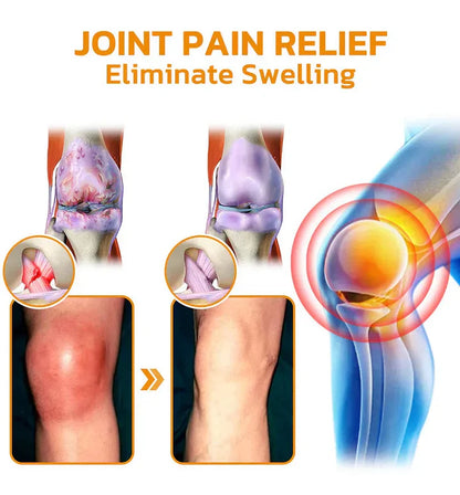 Official Store: TLOPA® Bee-Venom Pain-Relief Bone Healing Cream👨‍⚕️USA Osteopathic Medical Association （AAOS）Approved(Reducing joint swelling, pain, stiffness, redness, warmth, soreness, and joint fatigue)