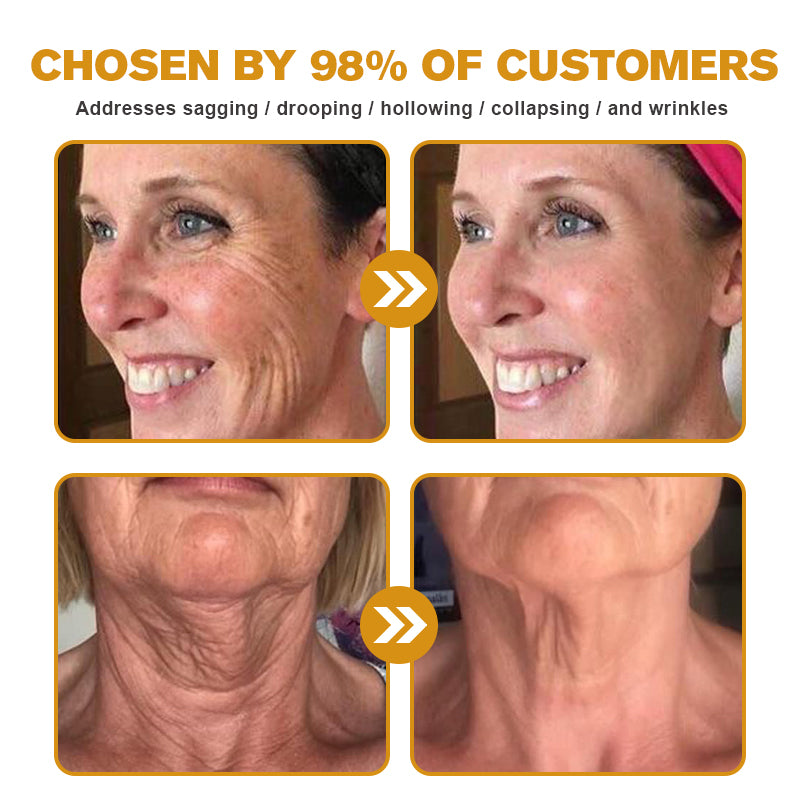 (Made and Shipped from USA) ✨TLOPA® Botox Bee Venom Wrinkle Removal Cream- LAST DAY 70% OFF✨