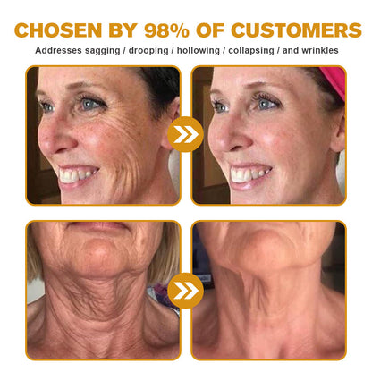 (Made and Shipped from USA) ✨TLOPA® Botox Bee Venom Wrinkle Removal Cream- LAST DAY 70% OFF✨