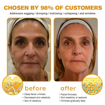 (Made and Shipped from USA) ✨TLOPA® Botox Bee Venom Wrinkle Removal Cream- LAST DAY 70% OFF✨